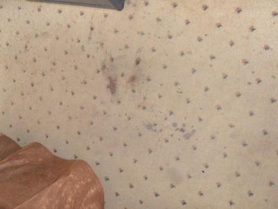 Recenze Fame Residence Park **** (Turecko - Kemer)