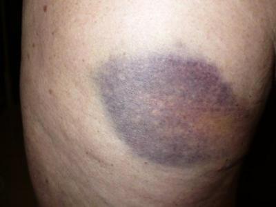 hodnocení dovolené v hotelu Mediteran, Podgora, Chorvatsko 