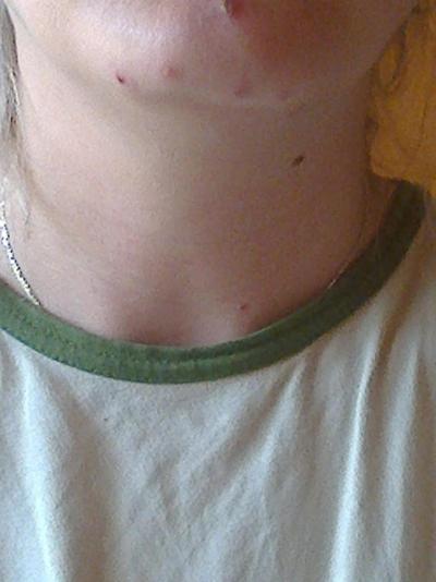 BOHUŽEL,ŠTĚNICE TAM JSOU NEUSTÁLE